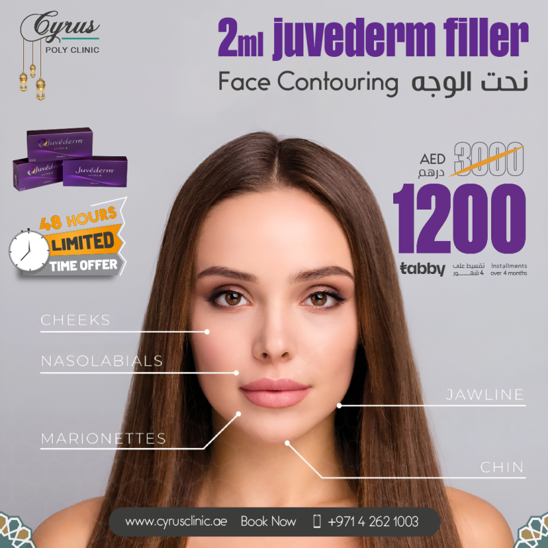 Face filler juv ads7 mars