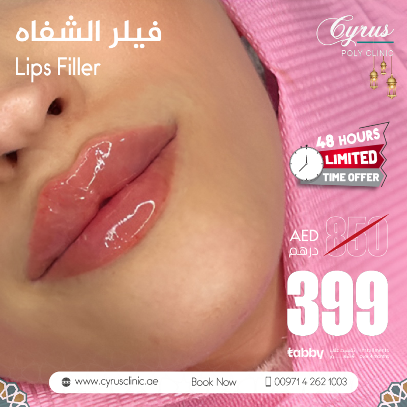 lips ads3 mars